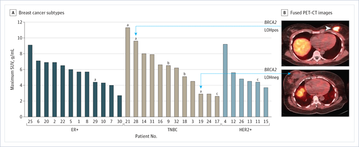 [18F]FluorThanatrace Maximum Standardized Uptake Value (SUV) vs Tumor Subtype - BCTRG study bar graph